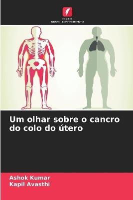 Um olhar sobre o cancro do colo do ?tero - Ashok Kumar,Kapil Avasthi - cover