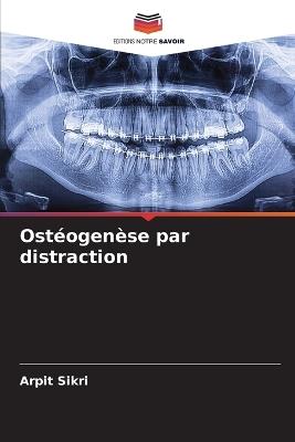 Ost?ogen?se par distraction - Arpit Sikri - cover