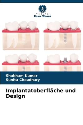 Implantatoberfl?che und Design - Shubham Kumar,Sunita Choudhary - cover