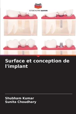 Surface et conception de l'implant - Shubham Kumar,Sunita Choudhary - cover