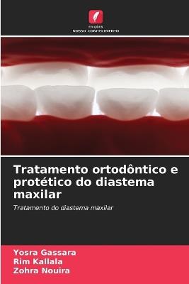 Tratamento ortod?ntico e prot?tico do diastema maxilar - Yosra Gassara,Rim Kallala,Zohra Nouira - cover
