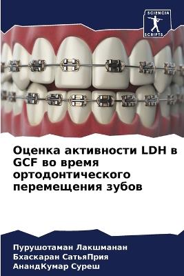 ?????? ?????????? Ldh ? Gcf ?? ????? ??????????k - ?????????? ?????????,????????? ?????????,?????????? ????? - cover