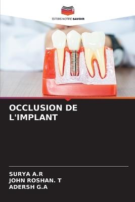 Occlusion de l'Implant - Surya A R,John Roshan T,Adersh G a - cover