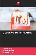Oclus?o Do Implante