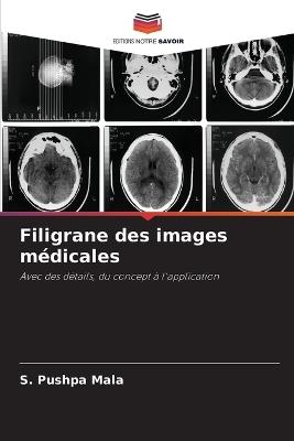 Filigrane des images m?dicales - S Pushpa Mala - cover