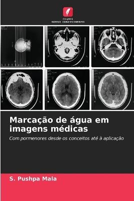 Marca??o de ?gua em imagens m?dicas - S Pushpa Mala - cover