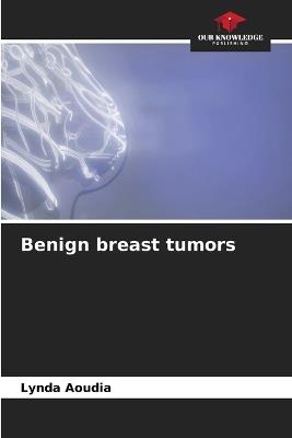 Benign breast tumors - Lynda Aoudia - cover