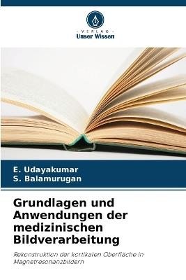 Grundlagen und Anwendungen der medizinischen Bildverarbeitung - E Udayakumar,S Balamurugan - cover