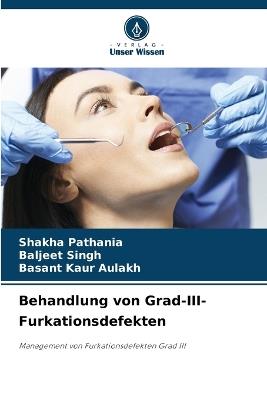 Behandlung von Grad-III-Furkationsdefekten - Shakha Pathania,Baljeet Singh,Basant Kaur Aulakh - cover