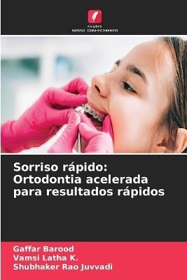 Sorriso rápido: Ortodontia acelerada para resultados rápidos - Gaffar Barood,Vamsi Latha K,Shubhaker Rao Juvvadi - cover