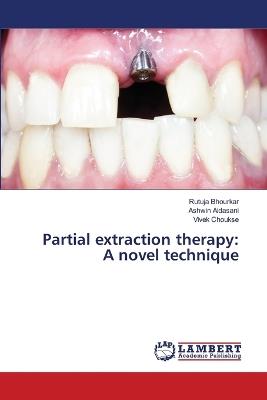 Partial extraction therapy: A novel technique - Rutuja Bhourkar,Ashwin Aidasani,Vivek Choukse - cover