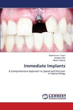 Immediate Implants