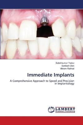 Immediate Implants - Satishkumar Yadav,Santosh Dixit,Vikram Rathod - cover
