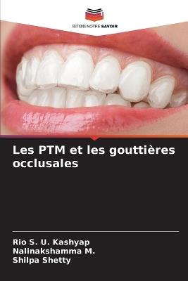 Les PTM et les gouttières occlusales - Rio S U Kashyap,Nalinakshamma M,Shilpa Shetty - cover