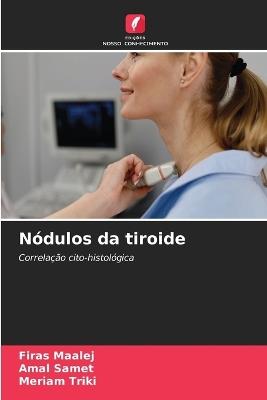 Nódulos da tiroide - Firas Maalej,Amal Samet,Meriam Triki - cover