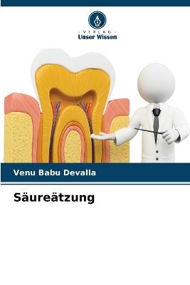Säureätzung - Venu Babu Devalla - cover