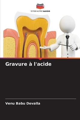 Gravure à l'acide - Venu Babu Devalla - cover