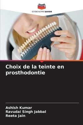 Choix de la teinte en prosthodontie - Ashish Kumar,Ravudai Singh Jabbal,Reeta Jain - cover