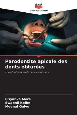 Parodontite apicale des dents obturées - Priyanka More,Swapnil Kolhe,Meenal Gulve - cover