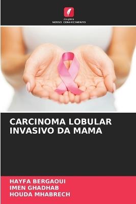 Carcinoma Lobular Invasivo Da Mama - Hayfa Bergaoui,Imen Ghadhab,Houda Mhabrech - cover