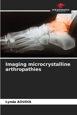 Imaging microcrystalline arthropathies - Lynda Aoudia - cover
