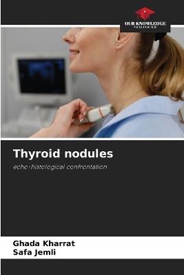 Thyroid nodules - Ghada Kharrat,Safa Jemli - cover