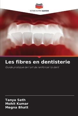 Les fibres en dentisterie - Tanya Seth,Mohit Kumar,Megna Bhatt - cover