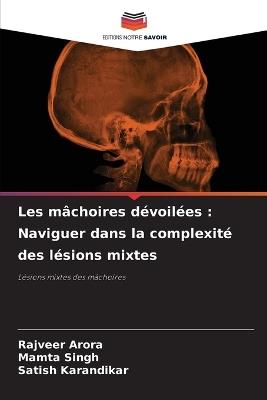 Les mâchoires dévoilées: Naviguer dans la complexité des lésions mixtes - Rajveer Arora,Mamta Singh,Satish Karandikar - cover