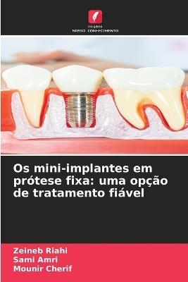 Os mini-implantes em prótese fixa: uma opção de tratamento fiável - Zeineb Riahi,Sami Amri,Mounir Cherif - cover