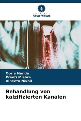Behandlung von kalzifizierten Kanälen - Oorja Nanda,Preeti Mishra,Vineeta Nikhil - cover