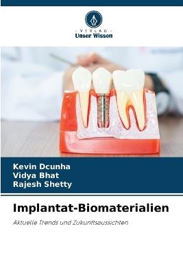 Implantat-Biomaterialien - Kevin Dcunha,Vidya Bhat,Rajesh Shetty - cover