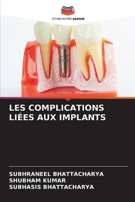Les Complications Liées Aux Implants - Subhraneel Bhattacharya,Shubham Kumar,Subhasis Bhattacharya - cover
