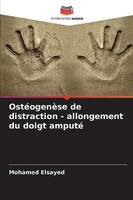 Ostéogenèse de distraction - allongement du doigt amputé - Mohamed Elsayed - cover