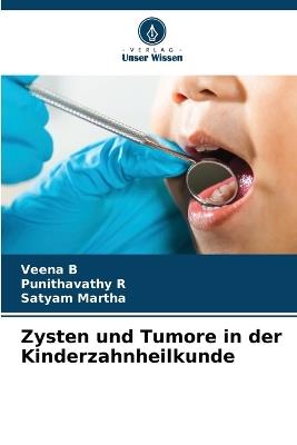 Zysten und Tumore in der Kinderzahnheilkunde - Veena B,Punithavathy R,Satyam Martha - cover