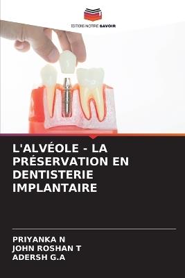 L'Alvéole - La Préservation En Dentisterie Implantaire - Priyanka N,John Roshan T,Adersh G a - cover