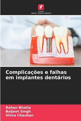 Complicações e falhas em implantes dentários - Rohan Bhatia,Baljeet Singh,Shiva Chauhan - cover