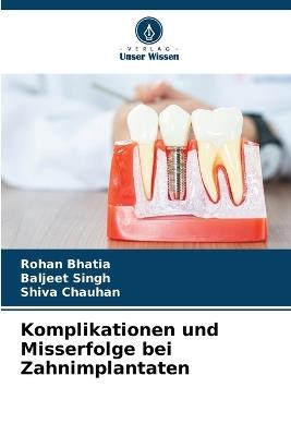 Komplikationen und Misserfolge bei Zahnimplantaten - Rohan Bhatia,Baljeet Singh,Shiva Chauhan - cover