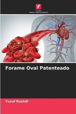Forame Oval Patenteado - Yusuf Rushdi - cover