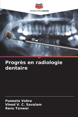 Progrès en radiologie dentaire - Puneeta Vohra,Vinod V C Savalam,Renu Tanwar - cover