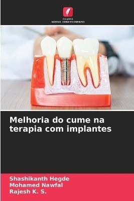Melhoria do cume na terapia com implantes - Shashikanth Hegde,Mohamed Nawfal,Rajesh K S - cover