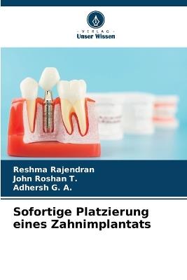 Sofortige Platzierung eines Zahnimplantats - Reshma Rajendran,John Roshan,Adhersh G a - cover