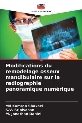 Modifications du remodelage osseux mandibulaire sur la radiographie panoramique numérique - Kamran Shakeel,S V Srinivasan,M Jonathan Daniel - cover