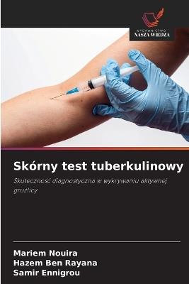 Skórny test tuberkulinowy - Mariem Nouira,Hazem Ben Rayana,Samir Ennigrou - cover