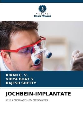 Jochbein-Implantate - Kiran C V,Vidya Bhat S,Rajesh Shetty - cover