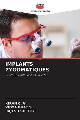 Implants Zygomatiques - Kiran C V,Vidya Bhat S,Rajesh Shetty - cover