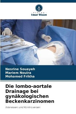 Die lombo-aortale Drainage bei gynäkologischen Beckenkarzinomen - Nesrine Souayeh,Mariem Nouira,Mohamed Frikha - cover