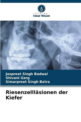 Riesenzellläsionen der Kiefer - Jaspreet Singh Badwal,Shivani Garg,Simarpreet Singh Batra - cover