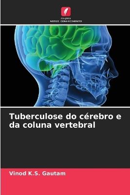 Tuberculose do cérebro e da coluna vertebral - Vinod K S Gautam - cover