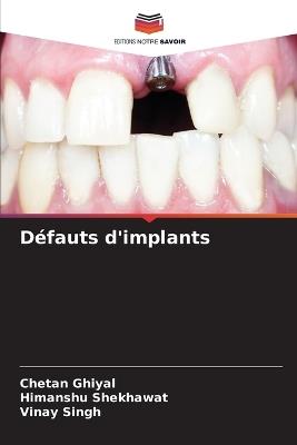 Défauts d'implants - Chetan Ghiyal,Himanshu Shekhawat,Vinay Singh - cover