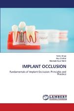 Implant Occlusion